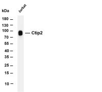STAT5A (PT0860R) PT® Rabbit mAb