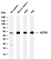 ATPB (PT0169R) PT® Rabbit mAb
