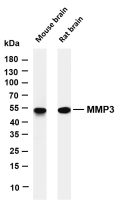 MMP3 (PT0292R) PT® Rabbit mAb