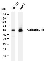Calreticulin (PT0256R) PT® Rabbit mAb
