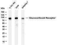 Glucocorticoid Receptor (PT0306R) PT® Rabbit mAb