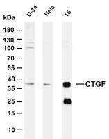 CTGF (PT0191R) PT® Rabbit mAb