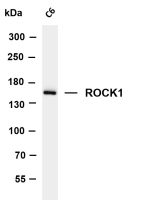 ROCK1 (PT0305R) PT® Rabbit mAb
