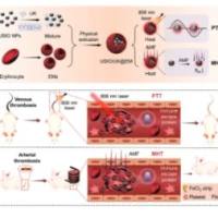 负载尿激酶的超顺磁性氧化铁纳米颗粒被红细胞膜包裹 UK@USPIO@RBC