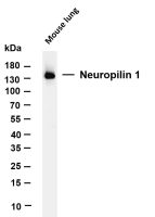 ACE2 (PT0172R) PT® Rabbit mAb