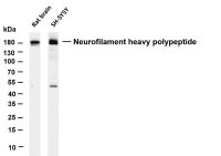 Neurofilament heavy polypeptide (PT0251R) PT® Rabbit mAb