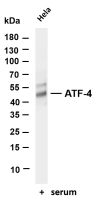 ATF-4 (PT0294R) PT® Rabbit mAb