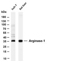 Arginase-1 (PT0364R) PT® Rabbit mAb