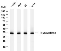 RPS6 (Phospho Ser240/Ser244) (PT0447R) PT® Rabbit mAb