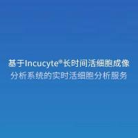 基于Incucyte®长时间活细胞成像分析系统的实时活细胞分析服务