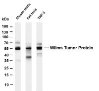 Wilms Tumor Protein (PT0302R) PT® Rabbit mAb