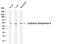 Carbonic Anhydrase 9 (PT0209R) PT® Rabbit mAb