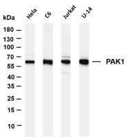 PAK1 (PT0342R) PT® Rabbit mAb