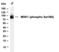 MSK1 (Phospho Ser360) (PT0174R) PT® Rabbit mAb