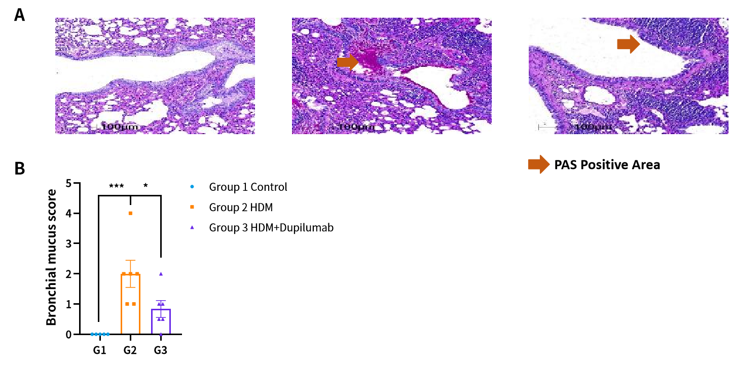 世界哮喘日 | 南模生物哮喘模型，助力探究哮喘新疗法