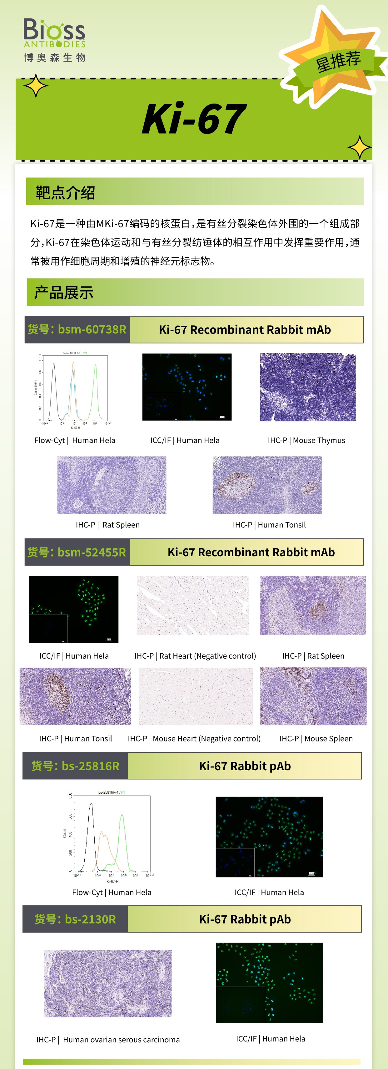 Bioss 星推荐 | Ki-67 抗体