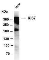 Ki67 (PT0321R) PT® Rabbit mAb