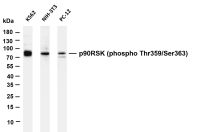 FOXP1 (PT0751R) PT® Rabbit mAb