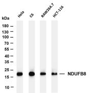 NDUFB8 (PT0369R) PT® Rabbit mAb
