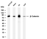 β Catenin (PT0300R) PT® Rabbit mAb