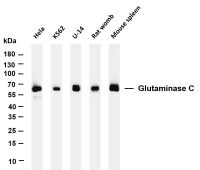 Glutaminase C (PT0168R) PT® Rabbit mAb