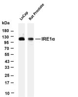 IRE1α (PT0365R) PT® Rabbit mAb