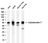 Cytokeratin 7 (PT0375R) PT® Rabbit mAb
