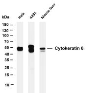 Cytokeratin 8 (PT0166R) PT® Rabbit mAb