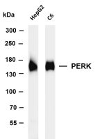 PERK (PT0310R) PT® Rabbit mAb