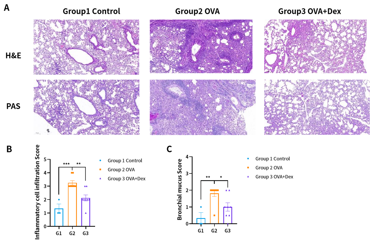 世界哮喘日 | 南模生物哮喘模型，助力探究哮喘新疗法