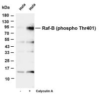 Raf-B (phospho Thr401) (PT0329R) PT® Rabbit mAb