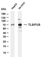 TLS/FUS (PT0308R) PT® Rabbit mAb