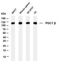 PGC1 β (PT0194R) PT® Rabbit mAb