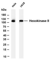 Hexokinase II (PT0189R) PT® Rabbit mAb