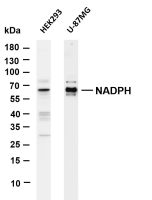 NADPH oxidase 4 (PT0181R) PT® Rabbit mAb
