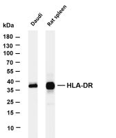 HLA-DR (PT0377R) PT® Rabbit mAb