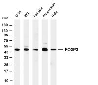FOXP3 (PT0211R) PT® Rabbit mAb