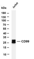 NDUFS3 (PT0465R) PT® Rabbit mAb