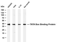 SIX2 (PT0546R) PT® Rabbit mAb
