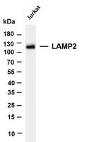 LAMP2 (PT0249R) PT® Rabbit mAb