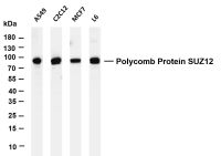 Polycomb Protein SUZ12 (PT0203R) PT® Rabbit mAb