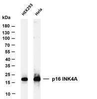 p16 INK4A (PT0242R) PT® Rabbit mAb