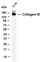 Collagen III (PT0180R) PT® Rabbit mAb
