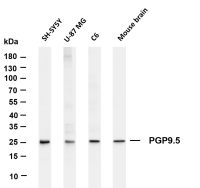 NDUFB8 (PT0387R) PT® Rabbit mAb
