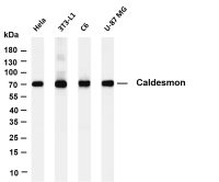 FXR1 (PT0694R) PT® Rabbit mAb