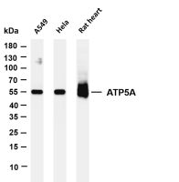ATP5A (PT0255R) PT® Rabbit mAb