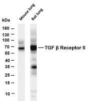 TGF β Receptor II (PT0368R) PT® Rabbit mAb