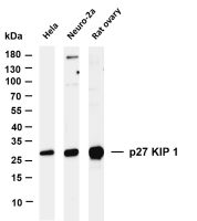 p27 KIP 1 (PT0324R) PT® Rabbit mAb