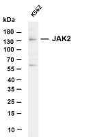 JAK2 (PT0503R) PT® Rabbit mAb