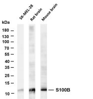 S100B (PT0461R) PT® Rabbit mAb